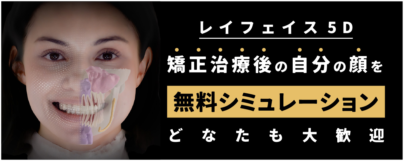 シミュレーション1